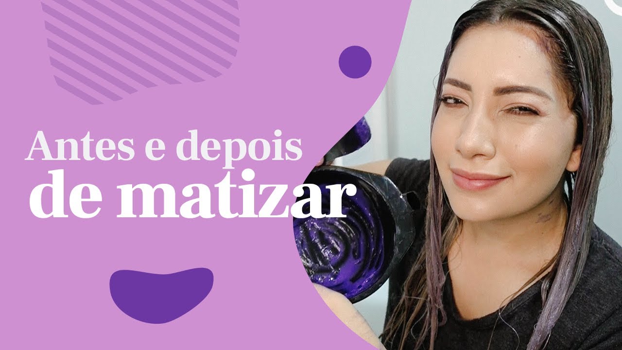 Antes e Depois de Matizar