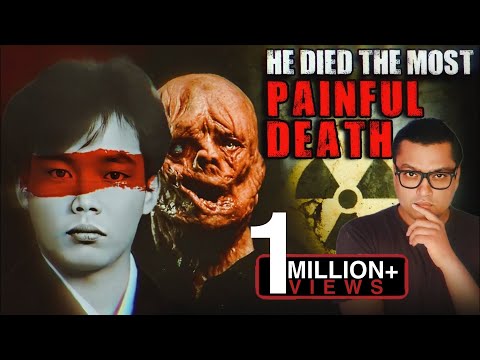 वो अपने मरे शरीर में 83 Days तक तड़पता रहा The Most Painful and Scary Story of Hisashi Ouchi
