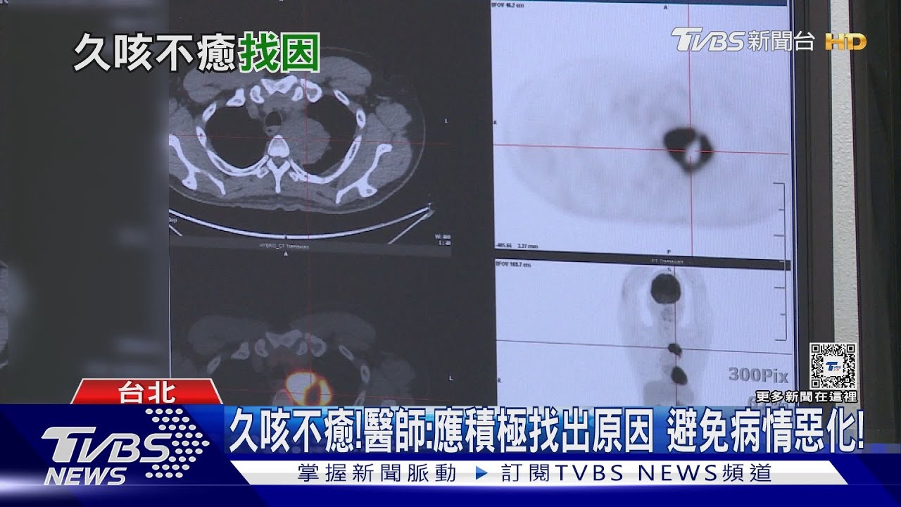長期久咳　小心「這疾病」找上門　醫師：若輕忽，病況更嚴重！