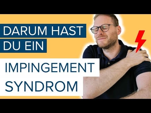 Ursachen Impingement Syndrom - Schulterschmerzen ⚡ ganzheitlich verstehen und angehen