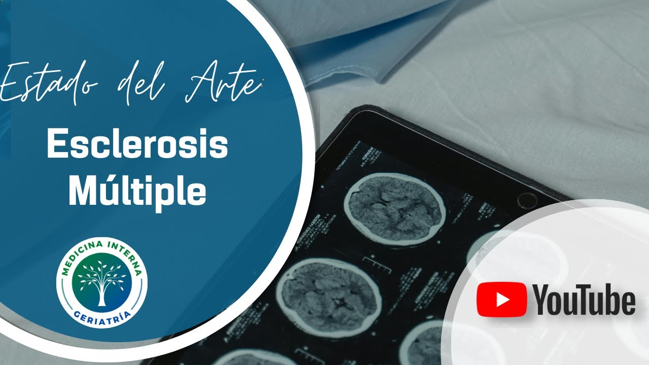 Esclerosis múltiple