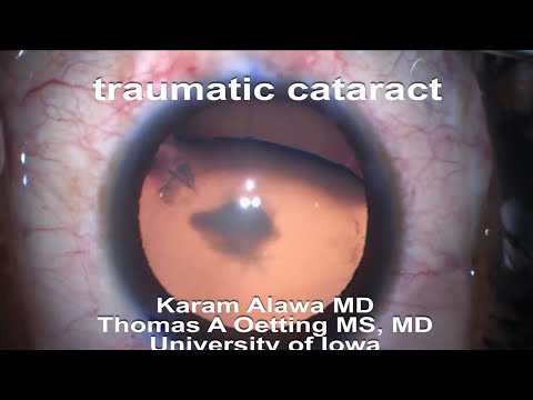 YouTube video