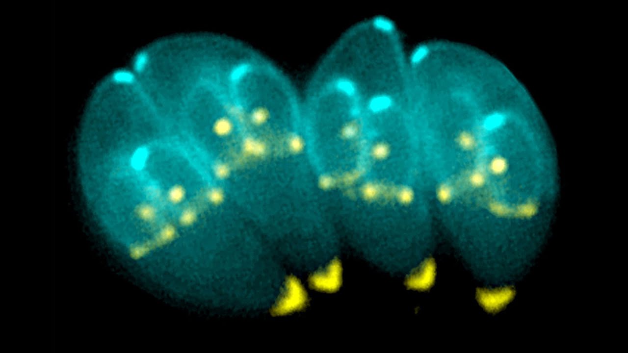 Half The World is Infected With This Parasite