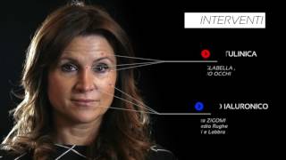 Trattamenti con acido ialuronico prima e dopo