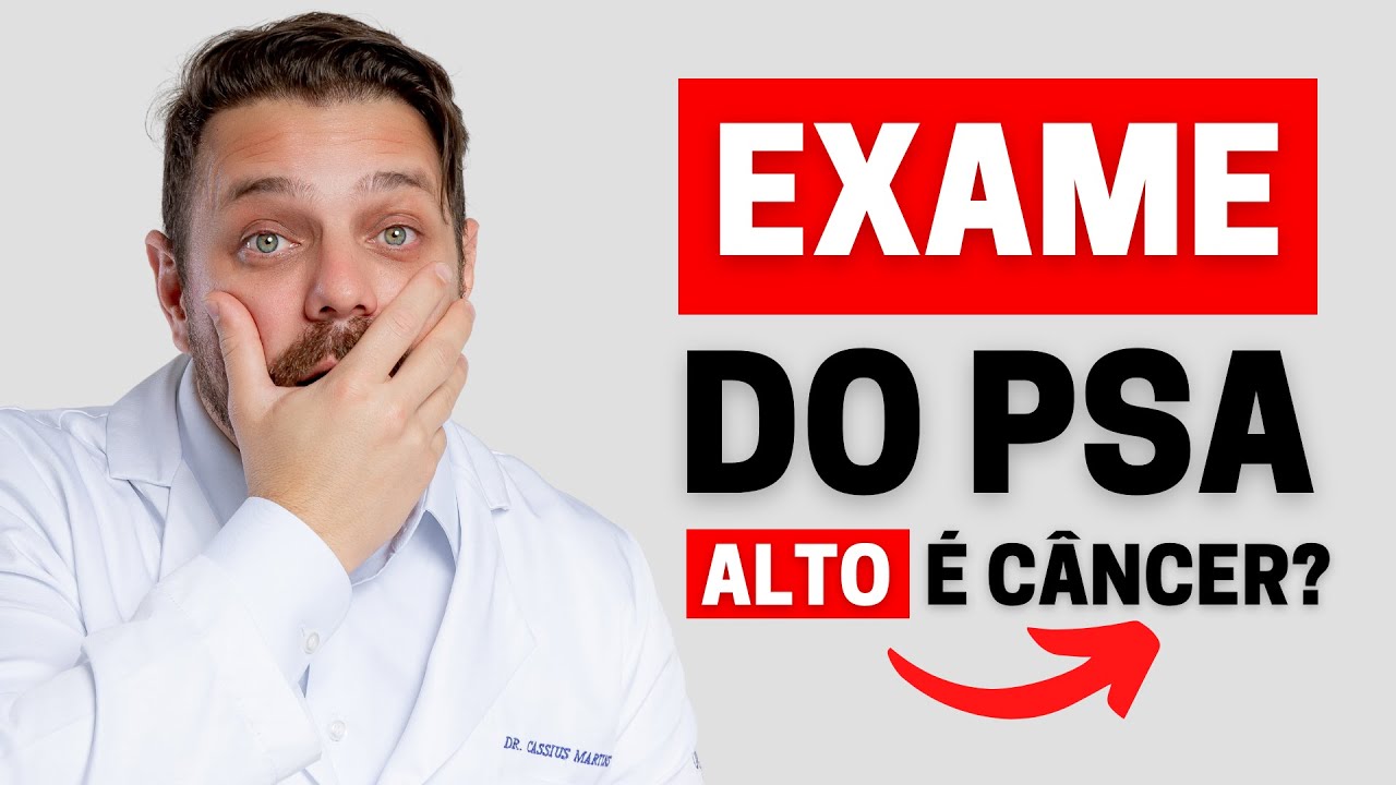 EXAME DO PSA ALTO: É CÂNCER DE PRÓSTATA? É POSSÍVEL REDUZIR OS NÍVEIS DE PSA? | DR. CASSIUS MARTINS