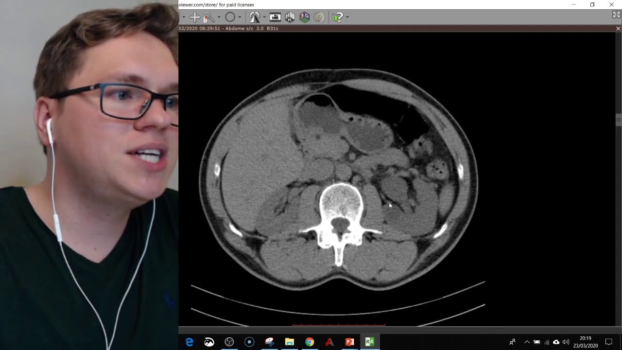 AVALIAÇÃO POR IMAGEM DAS PATOLOGIAS DO ABDOME - Tomografia do Abdome e Raio x do Abdome | LIVE #4