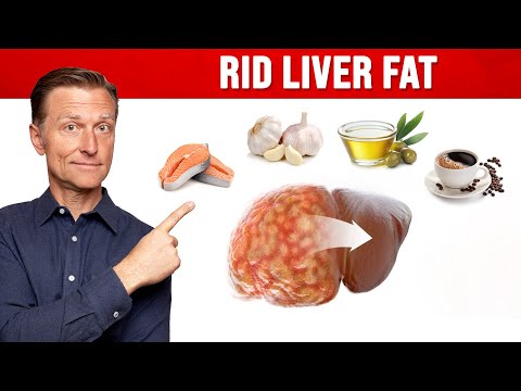 4 Critical Tips to Reverse a Fatty Liver – Dr Berg