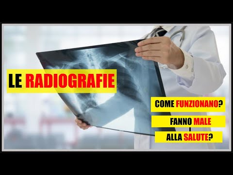 Come trattare ginocchio forum congiunto una cisti di Baker Benda sulla spalla prezzo orlett congiunta