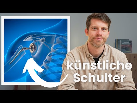 Schulterprothese | Wann ist sie wirklich nötig?