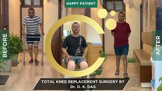Patient success Story | Both Knee Replacement Surgery by Dr. D K Das @CureMyKnee ​⁠