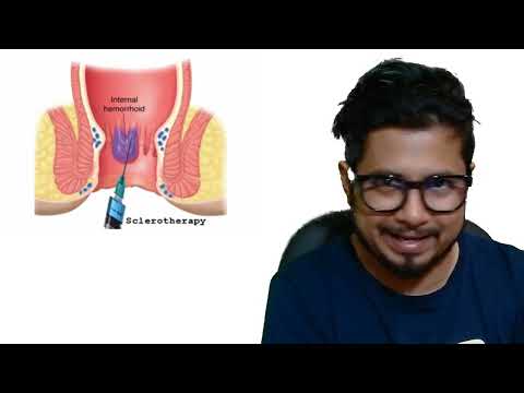 Laser surgery for piles fissure and fistula Laser treatment for piles fissure and fistula benefit