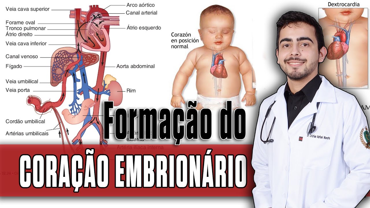 Desenvolvimento do Coração Embrionário - Cardiopatias Congênitas (PARTE 1) │ Fisiopatologia PORTH