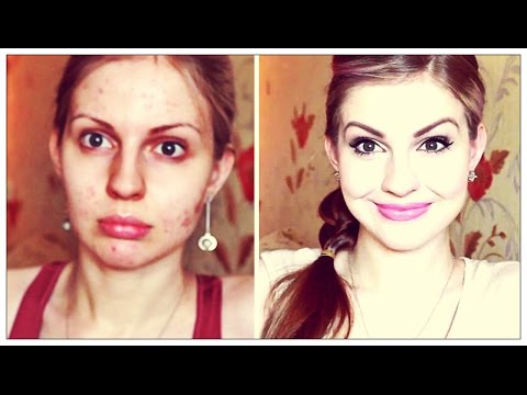 Как замаскировать прыщи?Макияж для проблемной кожи!Прыщи и макияж!Ваша Саша♥