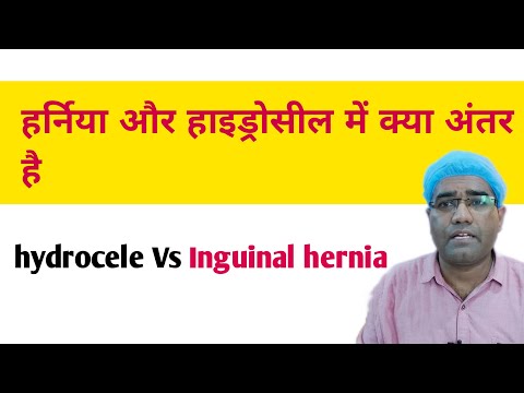 How To Difference Between Inguinal Hernia and Hydrocele | What is the difference between hernia a...