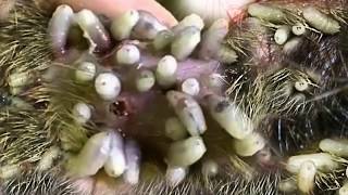 Cordylobia Anthropophaga vs Head Lice