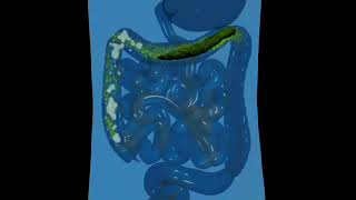 Your Gut Health, why DETOX