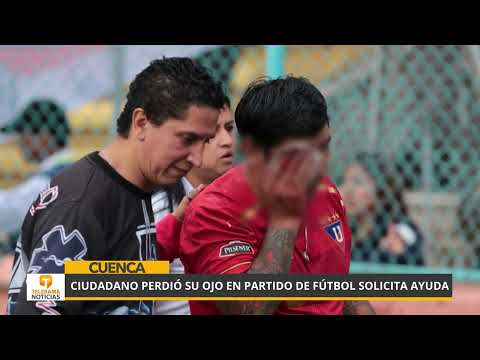 Ciudadano perdió su ojo en partido de fútbol solicita ayuda
