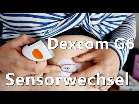 Dexcom G6 Sensorwechsel