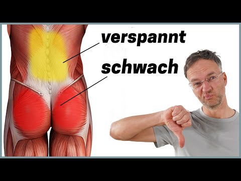 The most common cause of back pain (anatomy explained)