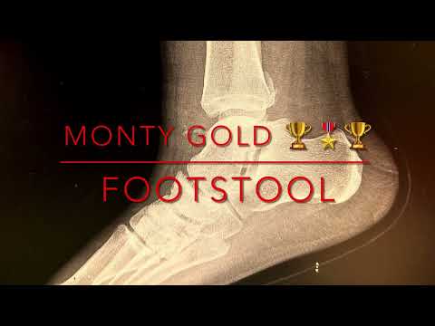 Monty Gold-Footstool 🏆🎖️🏆