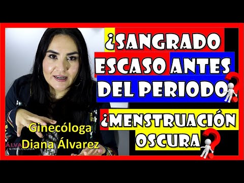 Dark periods? Light bleeding before your period? By gynecologist Diana Alvarez