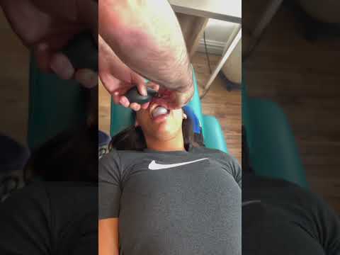 CRAZY CFR!! 😱 WAIT FOR IT!! 🎈