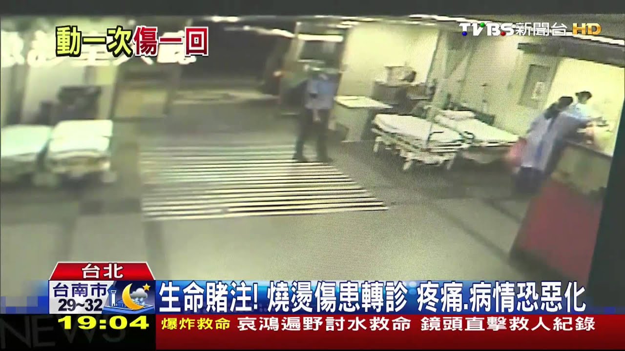 生命賭注!燒燙傷患轉診 疼痛、病情恐惡化