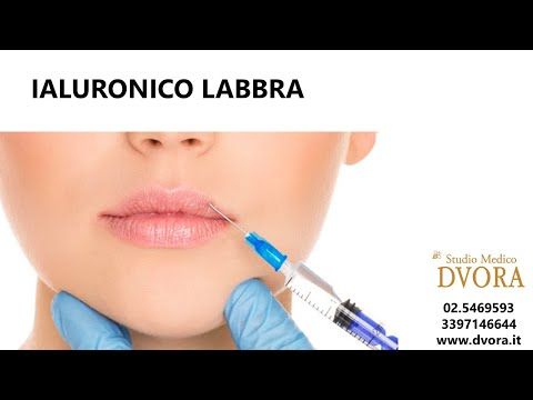 Giunto dolorante e gonfio del dito sulla mano in flessione Movimento hip limitata