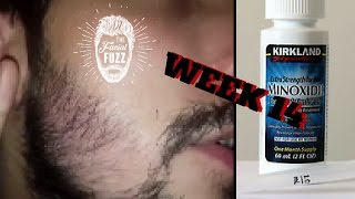 Minoxidil Beard | Week 14 | The Experiment |  #FacialFuzzFridays