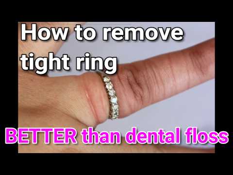 Remove STUCK ring!!