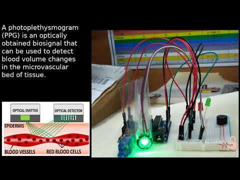 SBRC 2019 - WRNP Presentation - Healthsense Project