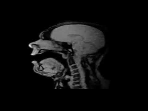 If a Guy Singing in an Opera is Scanned by MRI
