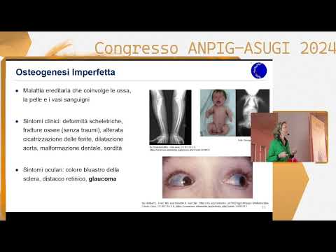 Congresso  - Genetica delle Collagenopatie