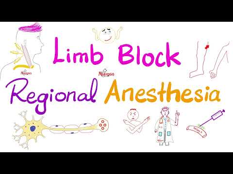 Limb Block | Peripheral Nerve Block | Regional anesthesia