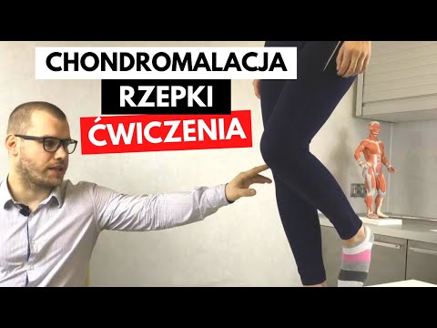 CHONDROMALACJA RZEPKI (uszkodzenie chrząstki stawowej) - TOP 3 Ćwiczenia