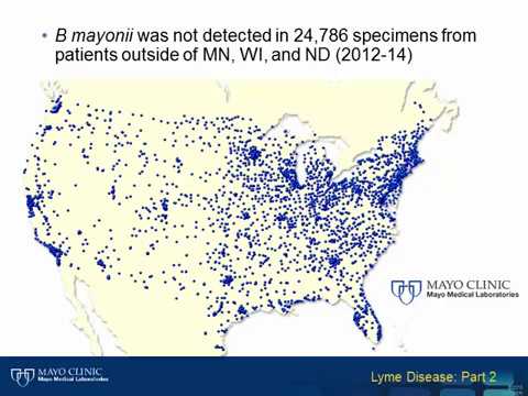 Lyme Disease Part 2: Borrelia mayonii–A New Cause of Lyme Disease in the Upper Midwest [Hot Topic]
