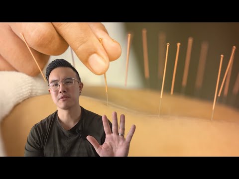 👀 踢爆！- 5 個關於乾針治療的迷思 (👀 DEBUNKED! - 5 Misconceptions About Dry Needling)