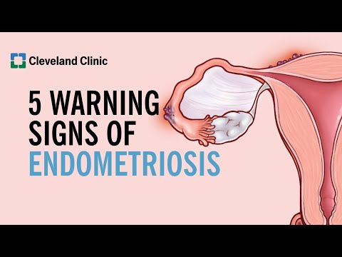 5 Warning Signs of Endometriosis