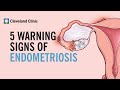 5 Warning Signs Of Endometriosis