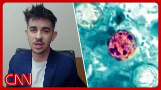 Diarrhea parasite cyclospora victim describes initial symptoms