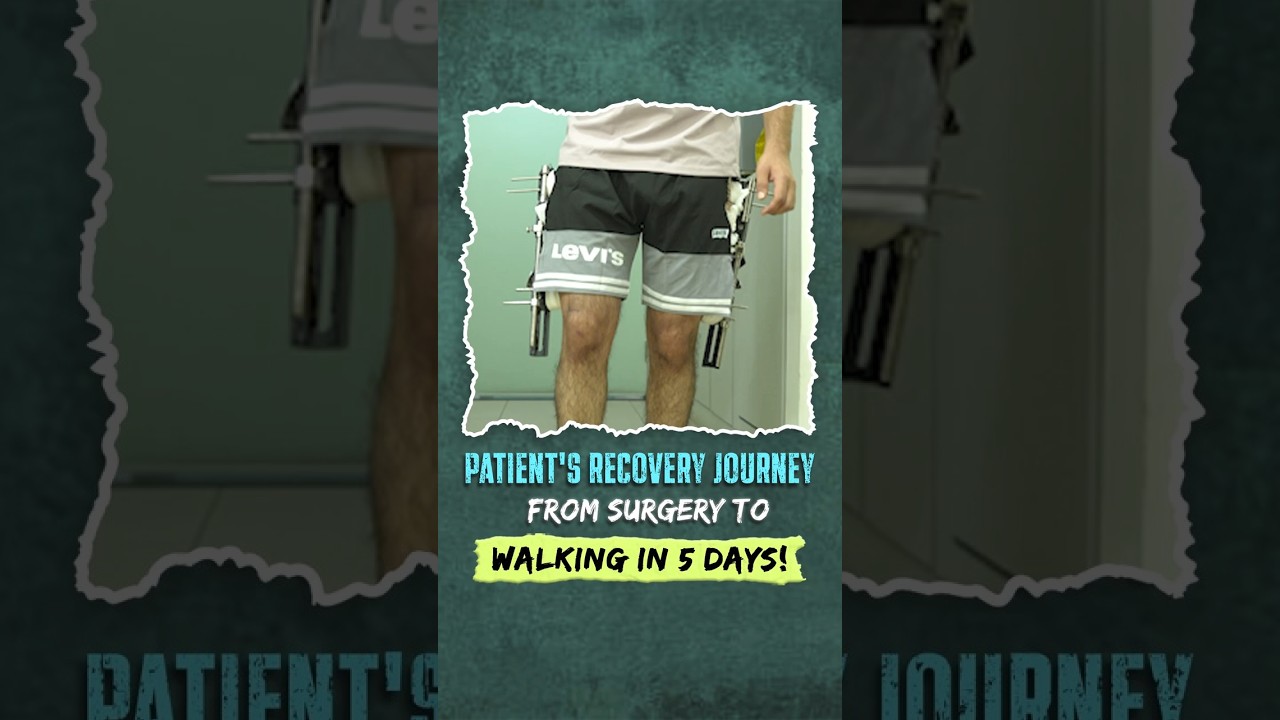 Patient Recovery Journey: Walking in 5 Days After Limb Lengthening Surgery | Heights Plus