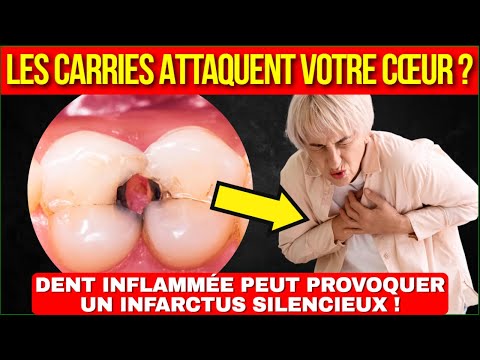 ⚠️ HEART IN DANGER - Discover what tartar and gingivitis can do to your arteries!