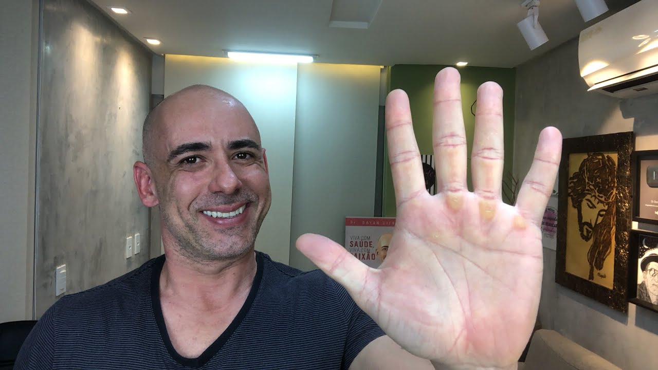 5 soluções naturais  para o mau hálito | Dr. Dayan Siebra