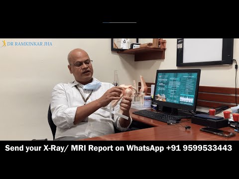 Bankart & Hill-sach Lesion, Labrum Tear, Recurrent Shoulder Dislocation: Causes & Treatment in India