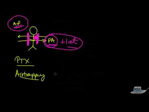 Chest X Ray Interpretation Explained Clearly