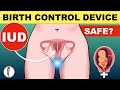 Intrauterine Device IUD For Pregnancy Control IUD Insertion Birth Control