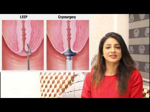 Diagnosis And Treatment Options For Cervical Cancer- Part 2