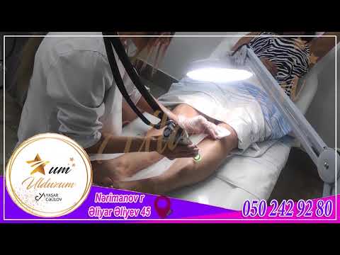 Ulduzum By Yashar Celilov Salonu - Lazer Epilyasiya Xidmetleri