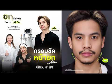 รีวิว Ultraformer MPT โปรแกรม Ultra 4D Lift คุณแจ็ค กิตติศักดิ์ ปรับกรอบหน้าคม