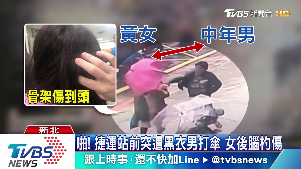 啪!捷運站前突遭黑衣男打傘 女後腦杓傷